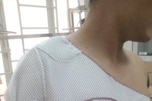 Hiệp sĩ bị đánh vì theo chân nhóm dàn cảnh cướp tài sản