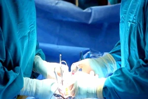 Xoắn tinh hoàn có đáng sợ?