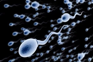 5 thói quen không ngờ làm suy giảm lượng tinh trùng