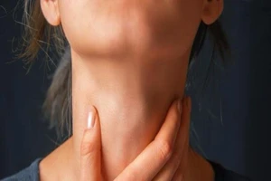 5 phương thuốc thảo dược chữa đau họng cực kỳ hiệu quả