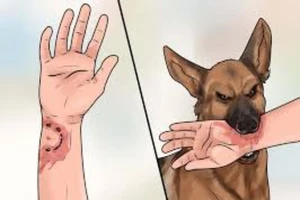 Chữa chó cắn bằng lá cây, bé trai thiệt mạng