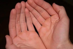 Những dấu hiệu tố bệnh trên bàn tay