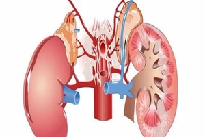 5 dấu hiệu cảnh báo ung thư thận