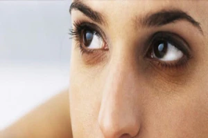 Quầng thâm ở mắt rất có thể là dấu hiệu bệnh gan, thận