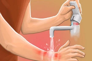 Cẩm nang xử trí cấp cứu các tai nạn thường gặp