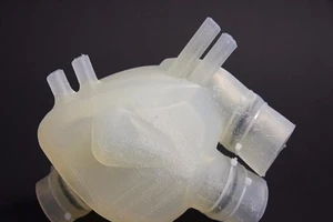 Không cần nguồn hiến tặng vẫn ghép được tim