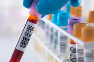 Bé 8 tuổi ‘đánh bại’ virus HIV