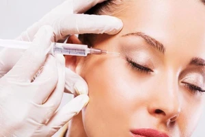 Bị mù vì tiêm chất làm đầy mặt ​