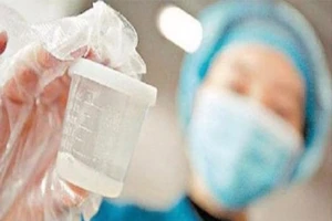 Màu sắc tinh dịch, khi nào là bệnh?