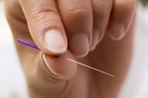 Có nên đâm kim vào dái tai để cứu người đột quỵ?