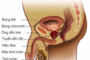 Hướng dẫn tự khám để phát hiện sớm ung thư tinh hoàn