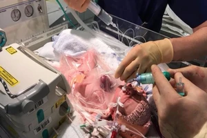 Bé gái tim ngoài lồng ngực sống sót thần kỳ