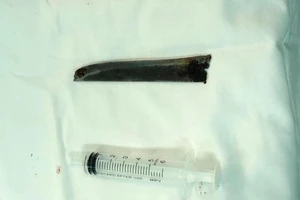 Lấy lưỡi dao dài 12 cm nằm 4 năm trong cơ thể bệnh nhân