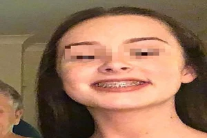 Suýt chết do miếng niềng răng đi lạc vào tim