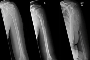 Người phụ nữ mắc bệnh cực hiếm, thế giới chỉ có 64 ca