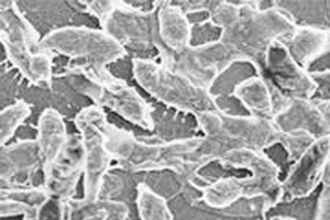 Tử vong do nhiễm vi khuẩn 'ăn thịt người' sau kỳ nghỉ