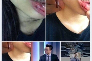 Thông tin chính thức vụ nữ sinh tố bị anh rể bạo hành