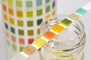 Màu sắc nước tiểu 'tiết lộ' gì về sức khỏe của bạn?