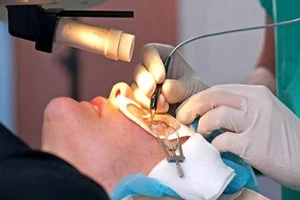 Có nên phẫu thuật chữa cận thị?