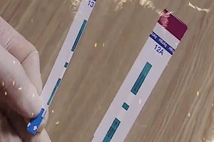 Vụ gian lận xét nghiệm HIV: Cục Phòng chống HIV/AIDS lên tiếng