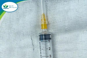 Bé 13 tháng tuổi bị sợi thép của rây lọc cháo đâm xuyên amidan