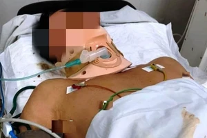 Người đàn ông bị tấm tôn trên xe ba gác cắt trúng cổ 