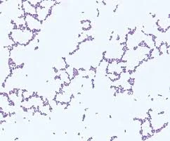 Người đàn ông bán thịt nhiễm liên cầu khuẩn lợn 