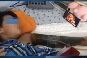 Báo động đỏ cứu bé trai bị máy trộn bê tông cuốn nát tay