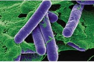 TP.HCM thông tin thêm về 2 trẻ nghi ngộ độc botulinum toxin