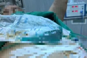 Hi hữu: Người đàn ông tự cắt dương vật vì đi tiểu khó