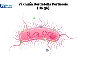 Làm sao để biết bị ho thường hay ho gà?
