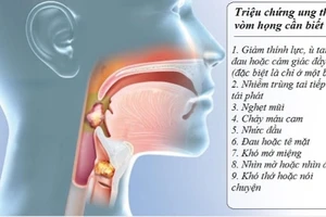 Các dấu hiệu sớm của ung thư vòm họng không nên bỏ qua