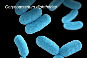 Các biến chứng nguy hiểm của bệnh bạch hầu, có thể gây tử vong