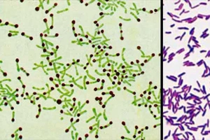 Nữ sinh tử vong do bạch hầu ở Nghệ An có tiếp xúc với 119 người