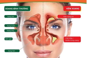 (Ảnh minh họa: Internet)