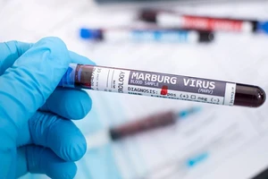 Bệnh Marburg có nguy cơ xâm nhập vào TP.HCM ở mức độ nào?