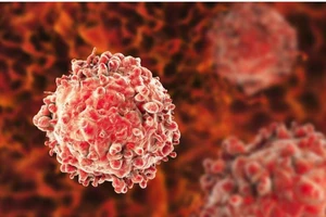 10 dấu hiệu cảnh báo sớm nguy cơ mắc bệnh ung thư