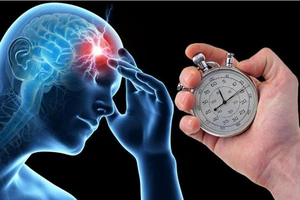 Các loại đột quỵ thường gặp nhất