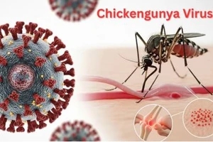 Vaccine sốt xuất huyết có ngừa được dịch bệnh Chikungunya?