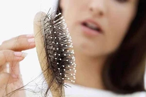 Những điều cần biết trước khi điều trị rụng tóc