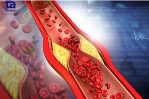 Những cách kiểm soát mỡ máu ở người cao tuổi