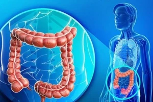 Hội chứng ruột kích thích có chữa khỏi được không?