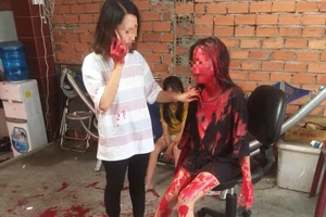 Cô gái 21 tuổi bị tạt sơn khắp người