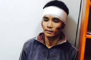 Nổ súng cướp tiệm vàng vào giữa trưa