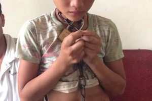 Công an tìm người thân của bé bị xích cổ