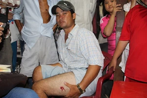 Nổ súng bắt sòng bầu cua, một người bị thương