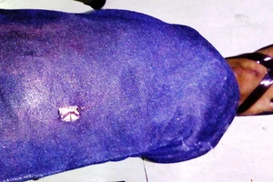 Nổ súng khi đuổi xe chở thuốc lá, tài xế tử vong