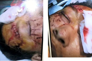 Công an TP.HCM chỉ đạo xử lý vụ bít nhà bằng container