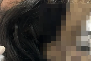 Thanh niên ở Ninh Thuận dùng búa tấn công vào vùng đầu đối phương