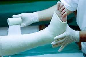 Truy tìm người tông cháu nhỏ gãy chân, chấn thương sọ não rồi bỏ trốn 